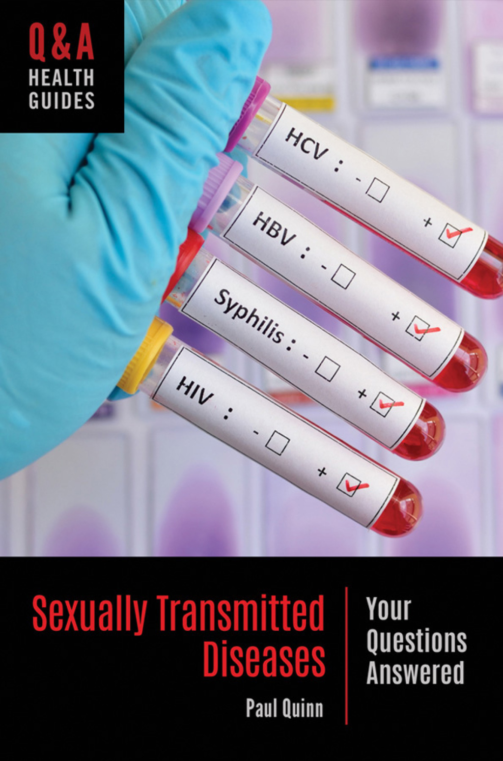 Sexually Transmitted Diseases Your Questions Answered 1st Edition