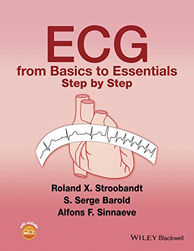ECG from Basics to Essentials: Step by Step (PDF/EPUB Version)
