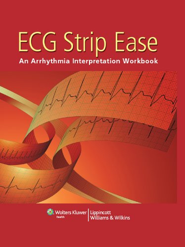 ECG Strip Ease: An Arrhythmia Interpretation Workbook (PDF/EPUB Version)