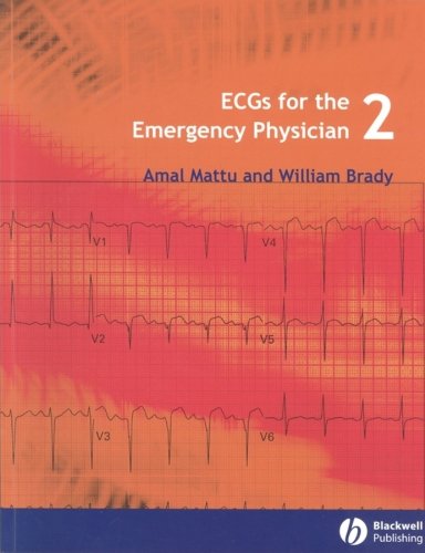 ECGs for the Emergency Physician 2 (PDF/EPUB Version)