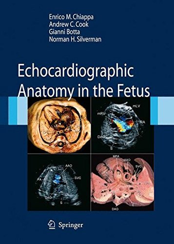Echocardiographic Anatomy in the Fetus (PDF/EPUB Version)