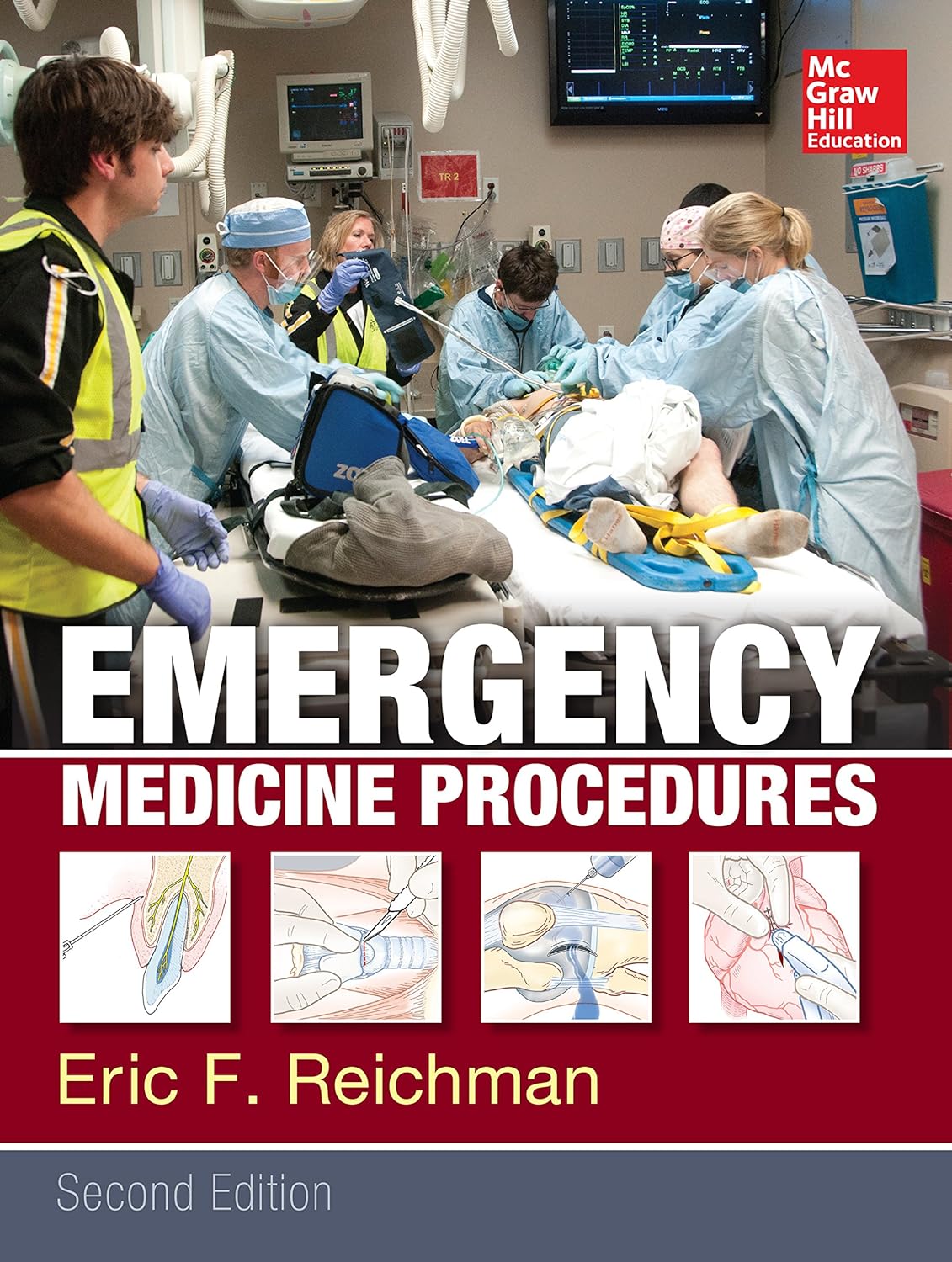 Emergency Medicine Procedures, Second Edition (PDF/EPUB Version)