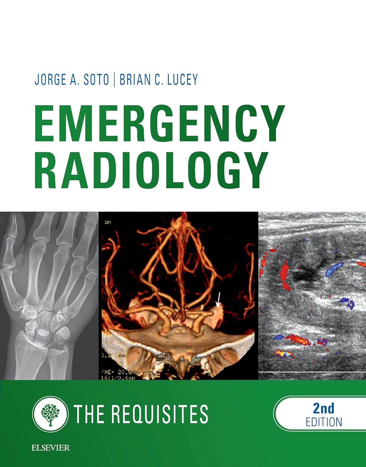 Emergency Radiology: The Requisites E-Book (Requisites in Radiology) (PDF/EPUB Version)