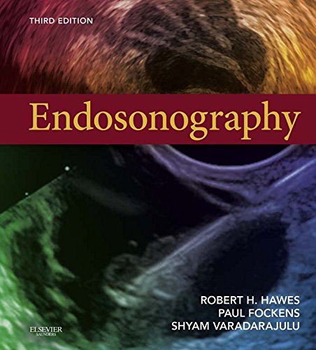 Endosonography (PDF/EPUB Version)