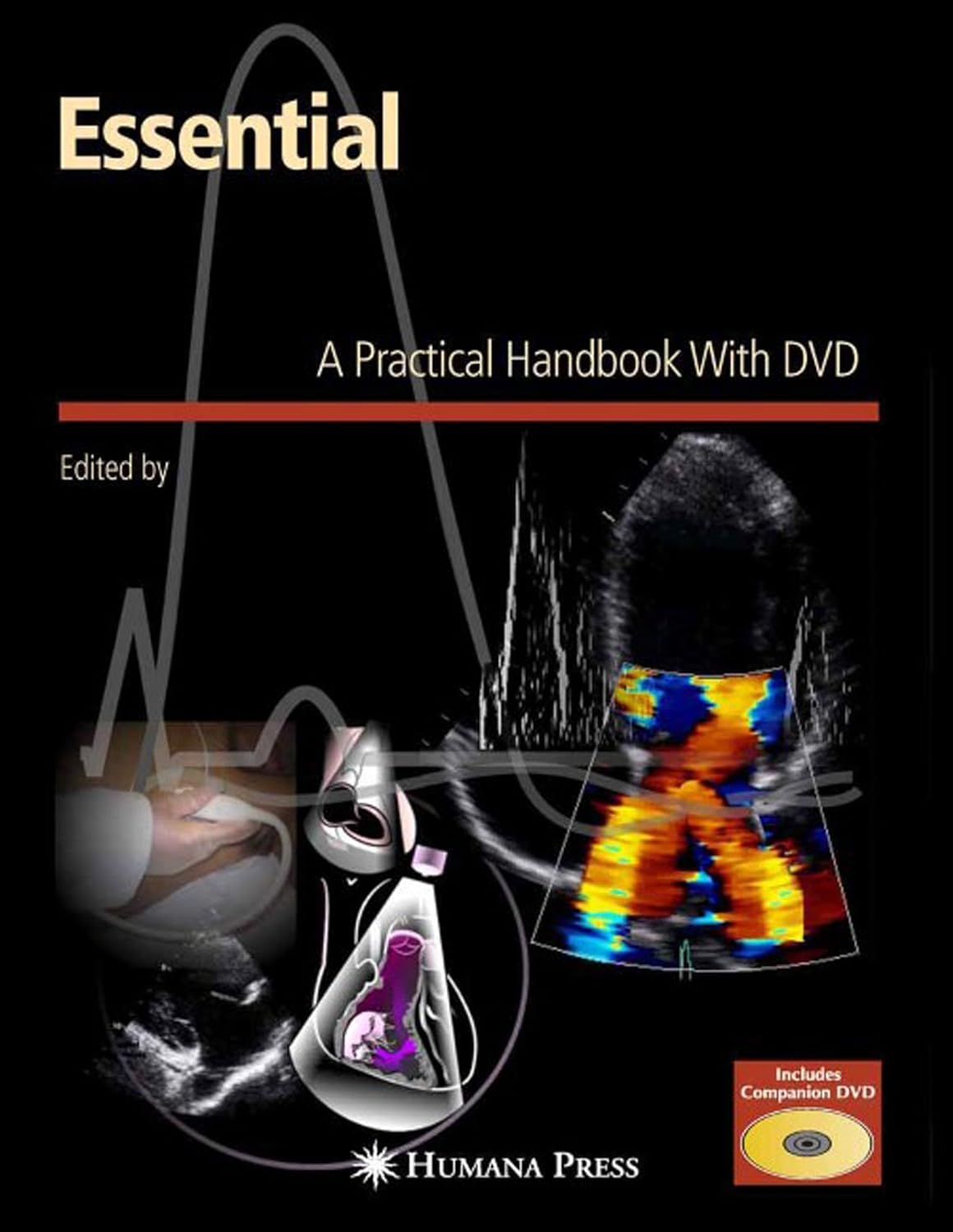 Essential Echocardiography: A Practical Guide With DVD (Contemporary Cardiology) (PDF/EPUB Version)