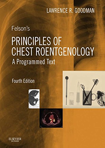 Felson's Principles of Chest Roentgenology E-Book (Goodman, Felson's Principles of Chest Roentgenology) (PDF/EPUB Version)