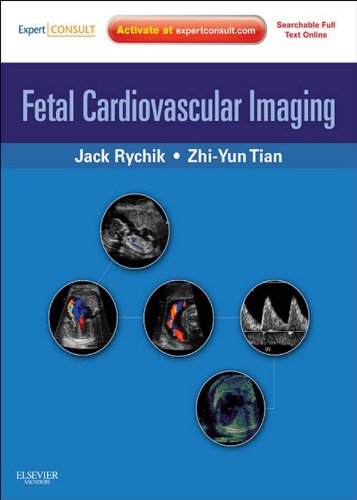 Fetal Cardiovascular Imaging: Expert Consult Premium (PDF/EPUB Version)