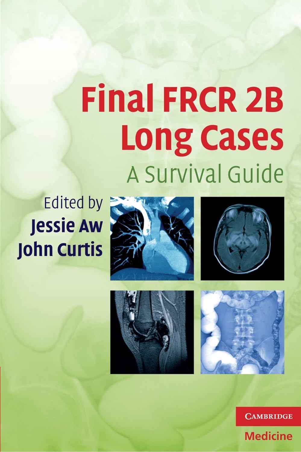 Final FRCR 2B Long Cases: A Survival Guide (Cambridge Medicine (Paperback)) (PDF/EPUB Version)