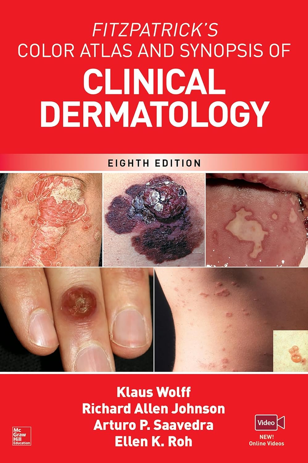 Fitzpatrick's Color Atlas and Synopsis of Clinical Dermatology, Eighth Edition (PDF/EPUB Version)