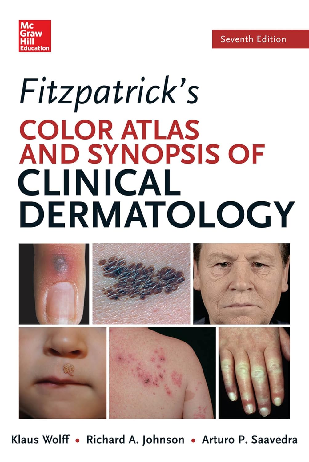 Fitzpatricks Color Atlas and Synopsis of Clinical Dermatology, Seventh Edition (Color Atlas & Synopsis of Clinical Dermatology (Fitzpatrick)) (PDF/EPUB Version)