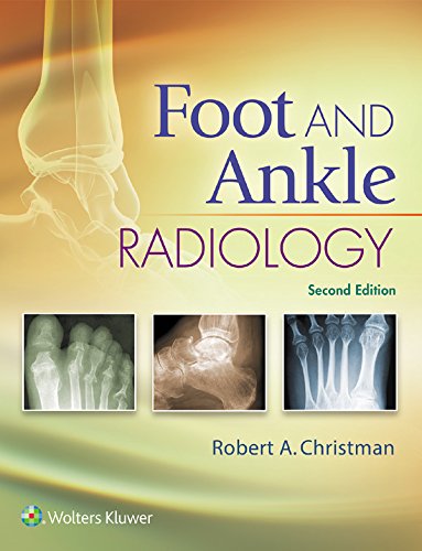 Foot and Ankle Radiology (PDF/EPUB Version)