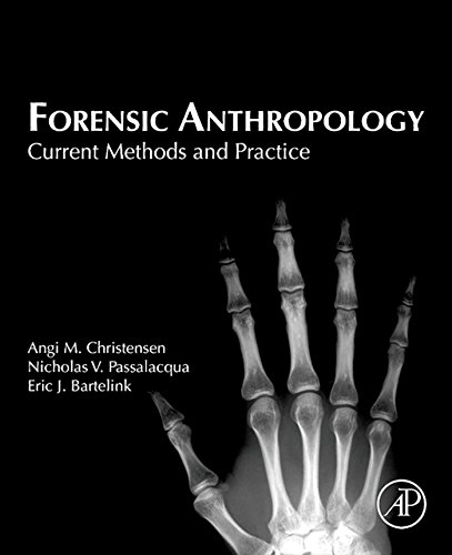 Forensic Anthropology: Current Methods and Practice (PDF/EPUB Version)