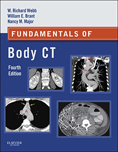 Fundamentals of Body CT E-Book (Fundamentals of Radiology) (PDF/EPUB Version)