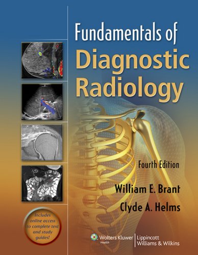 Fundamentals of Diagnostic Radiology (PDF/EPUB Version)