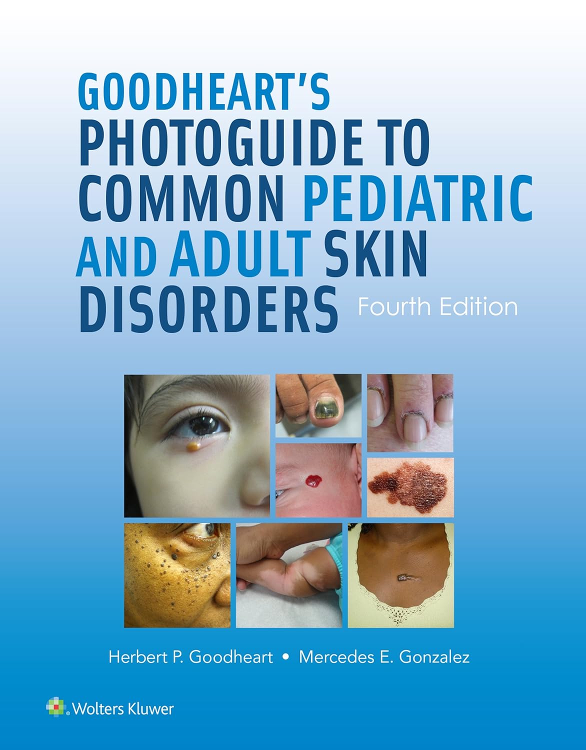 Goodheart's Photoguide to Common Pediatric and Adult Skin Disorders (PDF/EPUB Version)