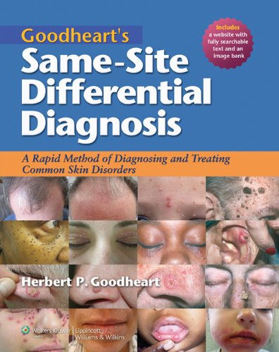 Goodheart's Same-Site Differential Diagnosis: A Rapid Method of Diagnosing and Treating Common Skin Disorders (PDF/EPUB Version)