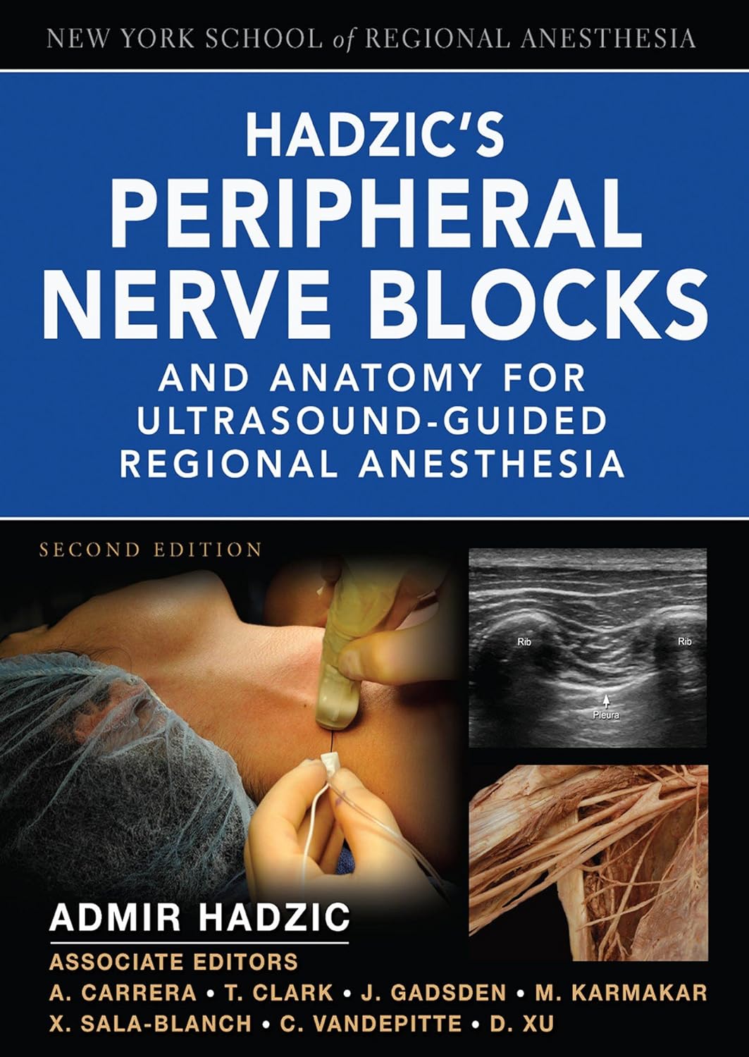 Hadzic's Peripheral Nerve Blocks and Anatomy for Ultrasound-Guided Regional Anesthesia (New York School of Regional Anesthesia) (PDF/EPUB Version)