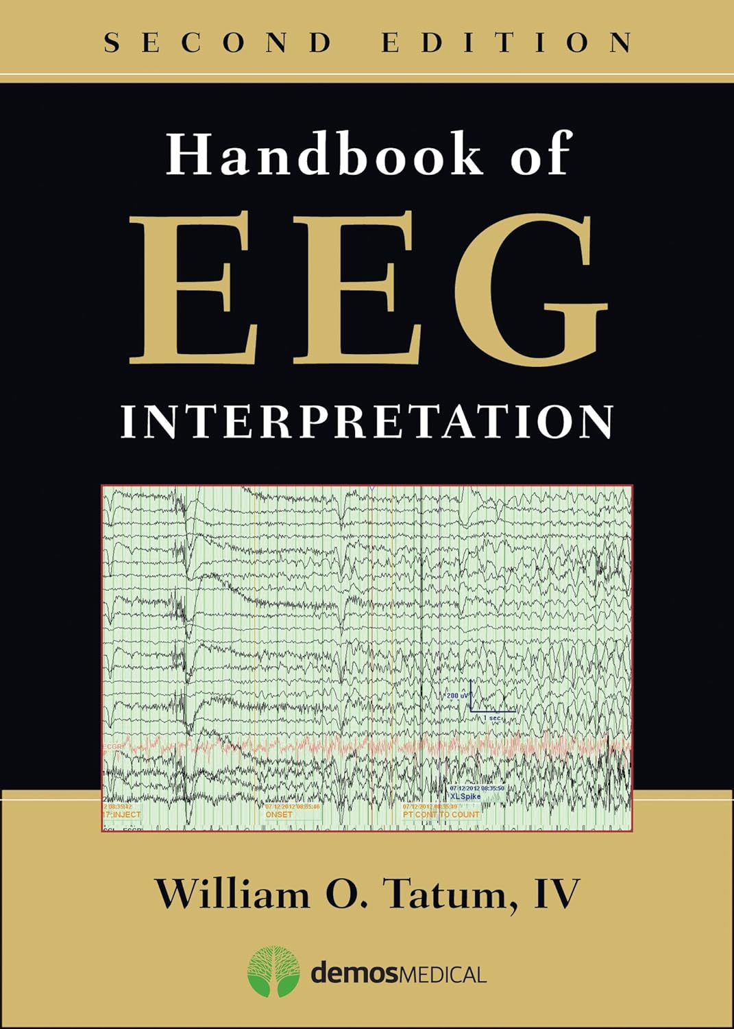 Handbook of EEG Interpretation, Second Edition (PDF/EPUB Version)