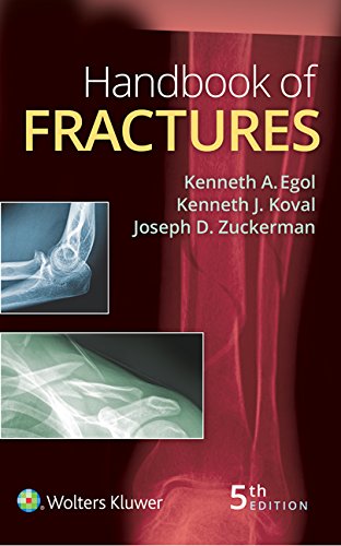 Handbook of Fractures (PDF/EPUB Version)