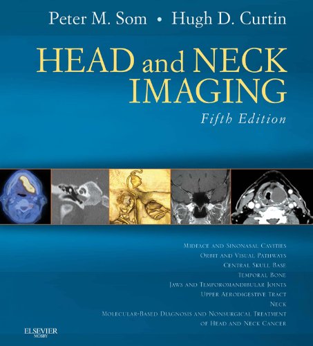 Head and Neck Imaging: Expert Consult- Online and Print (PDF/EPUB Version)