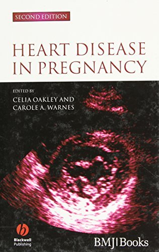 Heart Disease in Pregnancy (PDF/EPUB Version)