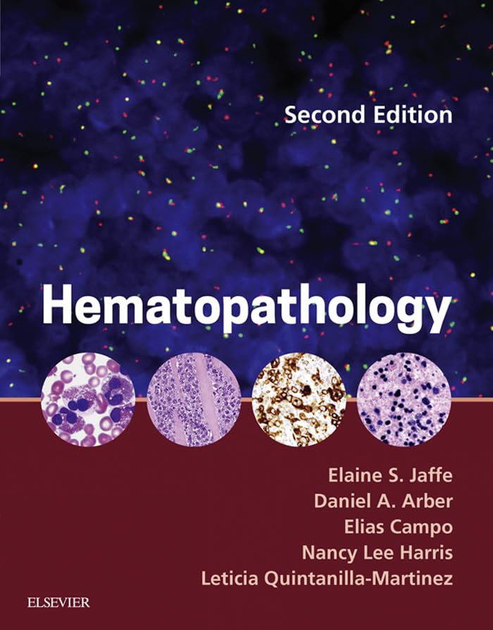 Hematopathology E-Book (PDF/EPUB Version)