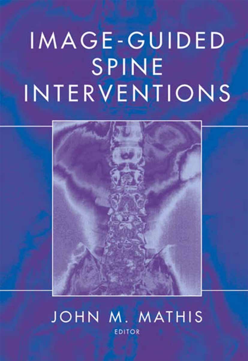 Image-Guided Spine Interventions (PDF/EPUB Version)