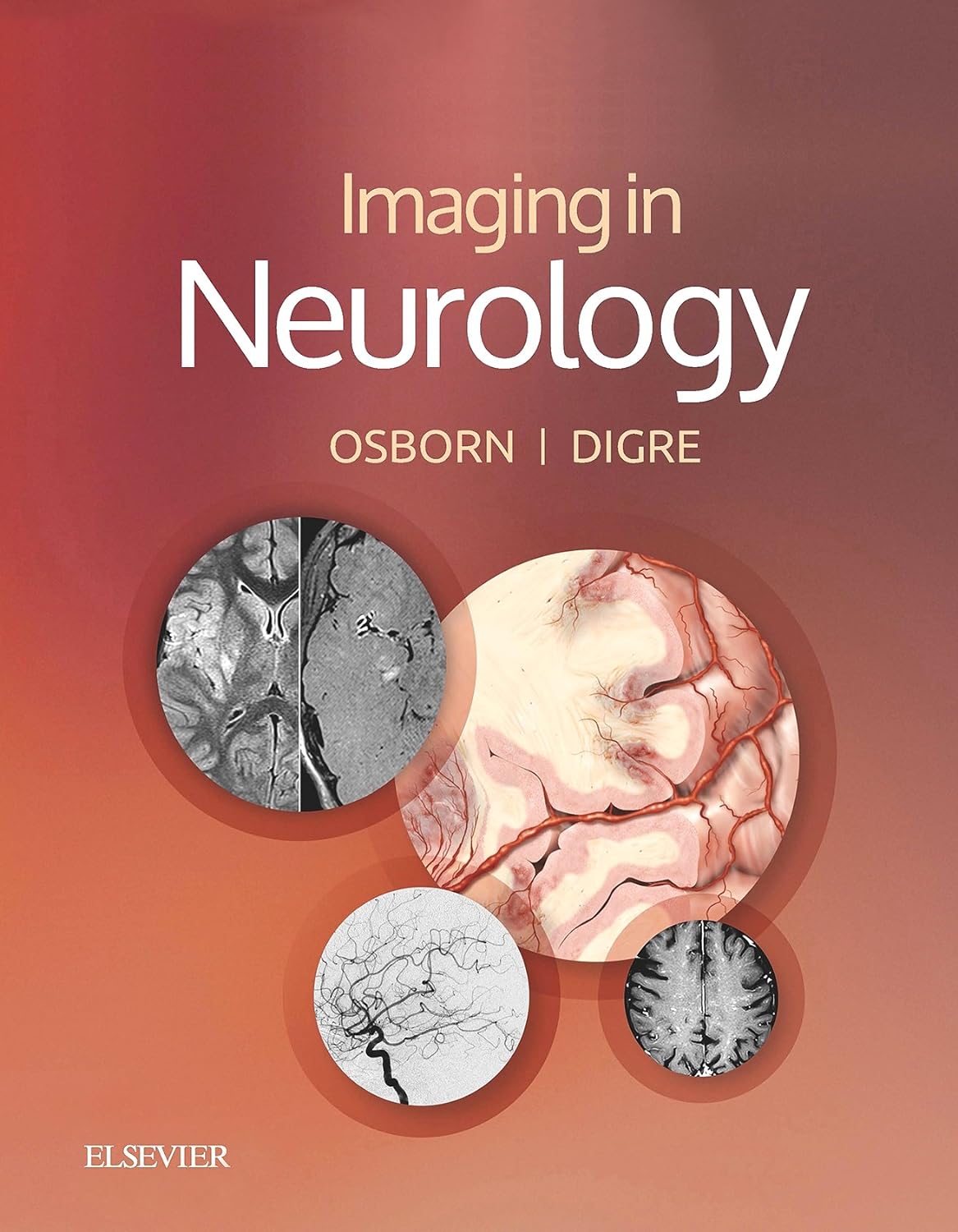 Imaging in Neurology E-Book (PDF/EPUB Version)