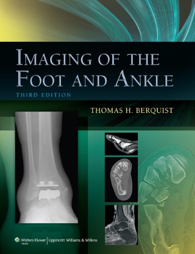 Imaging of the Foot and Ankle (PDF/EPUB Version)