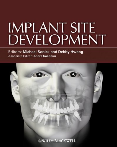 Implant Site Development (PDF/EPUB Version)