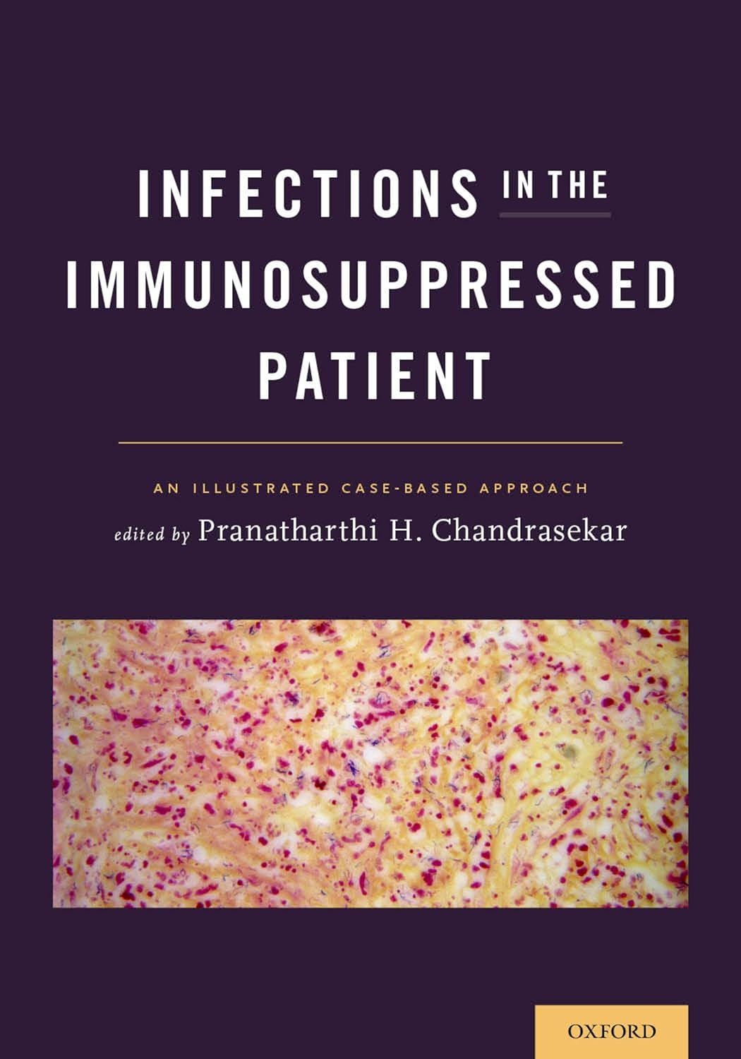 Infections in the Immunosuppressed Patient: An Illustrated Case-Based Approach (PDF/EPUB Version)