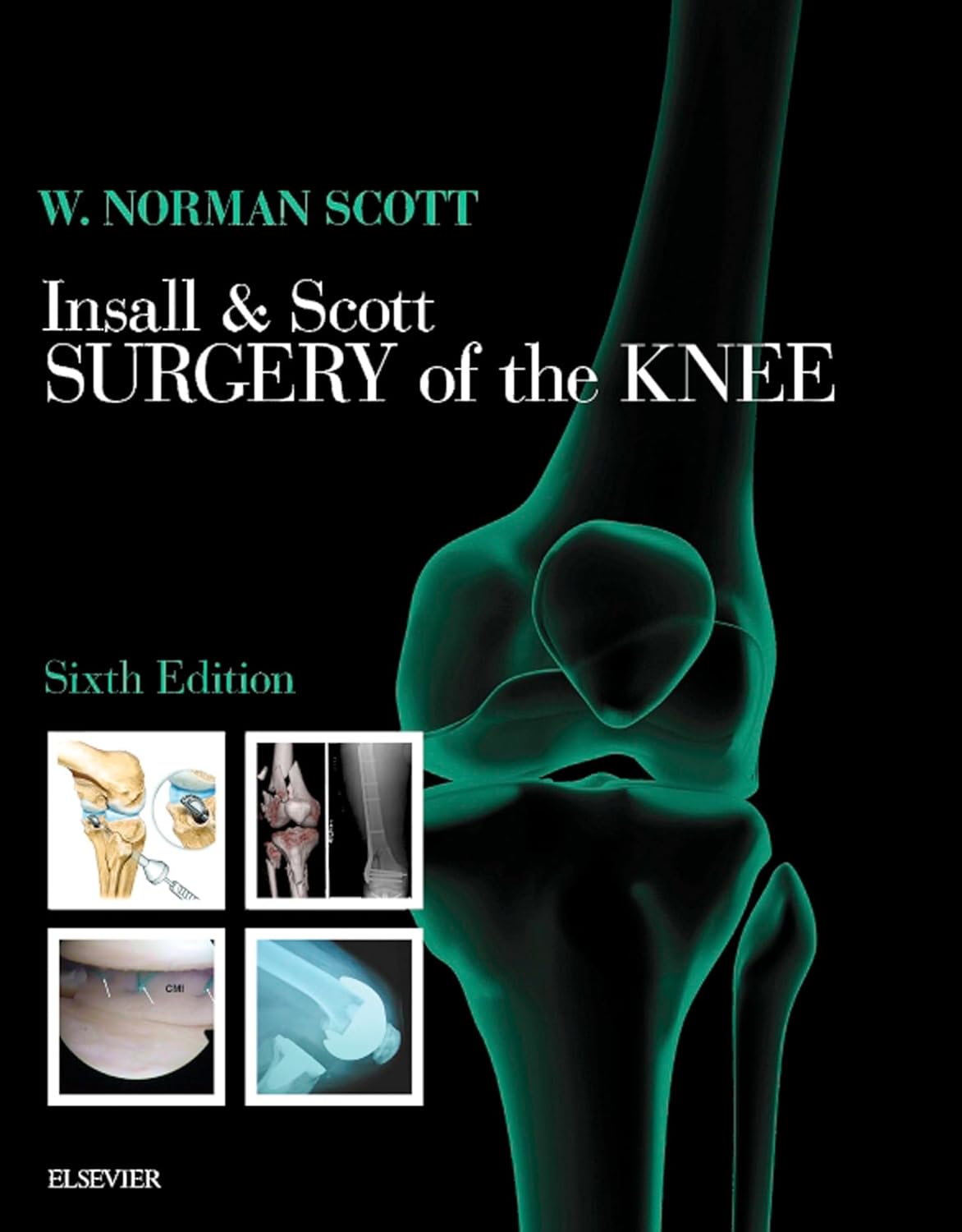 Insall & Scott Surgery of the Knee E-Book: Expert Consult - Online and Print (PDF/EPUB Version)