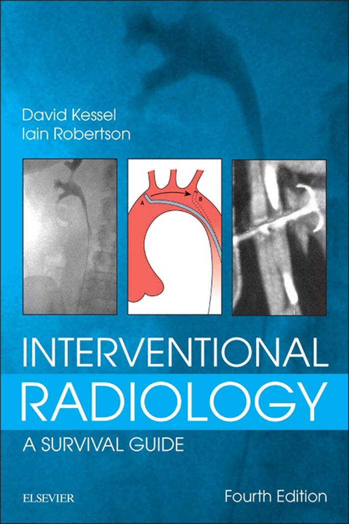 Interventional Radiology: A Survival Guide E-Book (PDF/EPUB Version)