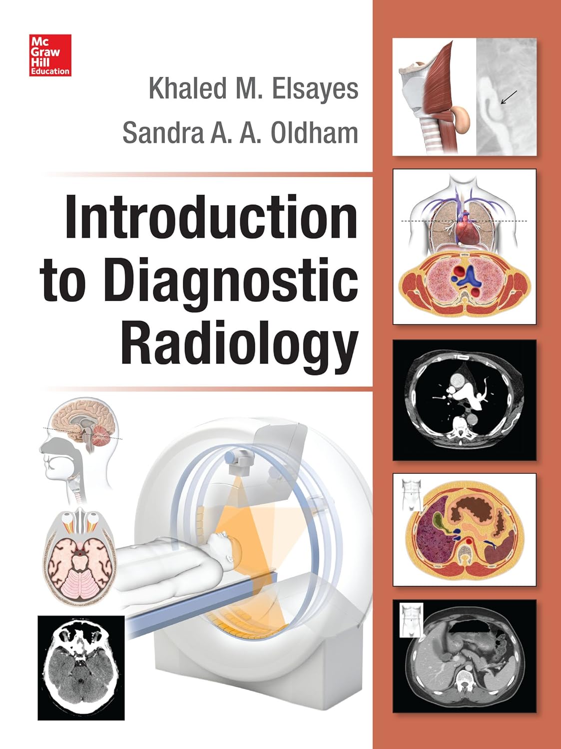 Introduction to Diagnostic Radiology (PDF/EPUB Version)
