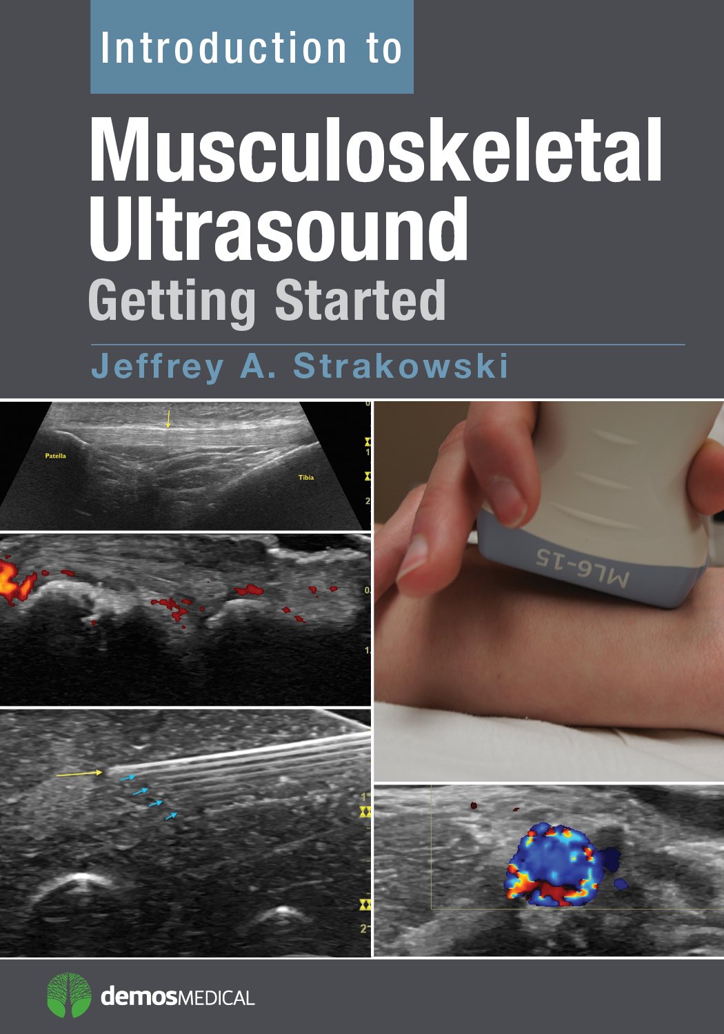 Introduction to Musculoskeletal Ultrasound: Getting Started (PDF/EPUB Version)