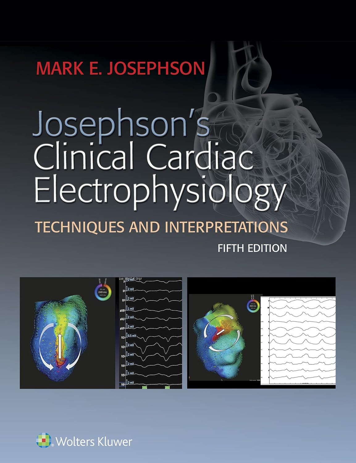 Josephson's Clinical Cardiac Electrophysiology (PDF/EPUB Version)