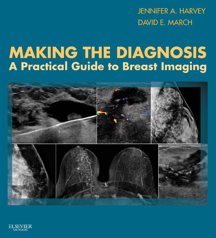 Making the Diagnosis: A Practical Guide to Breast Imaging E-Book: Expert Consult - Online and Print (PDF/EPUB Version)