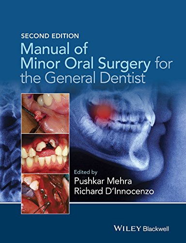 Manual of Minor Oral Surgery for the General Dentist (PDF/EPUB Version)