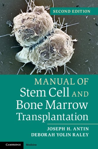 Manual of Stem Cell and Bone Marrow Transplantation (PDF/EPUB Version)