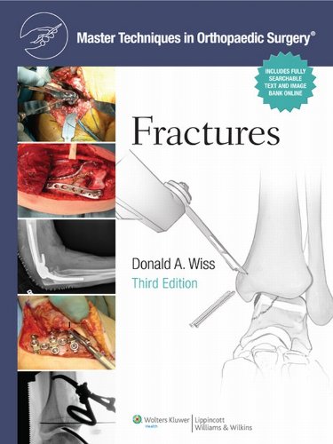 Master Techniques in Orthopaedic Surgery: Fractures (PDF/EPUB Version)