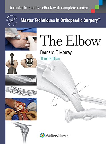 Master Techniques in Orthopaedic Surgery: The Elbow (PDF/EPUB Version)