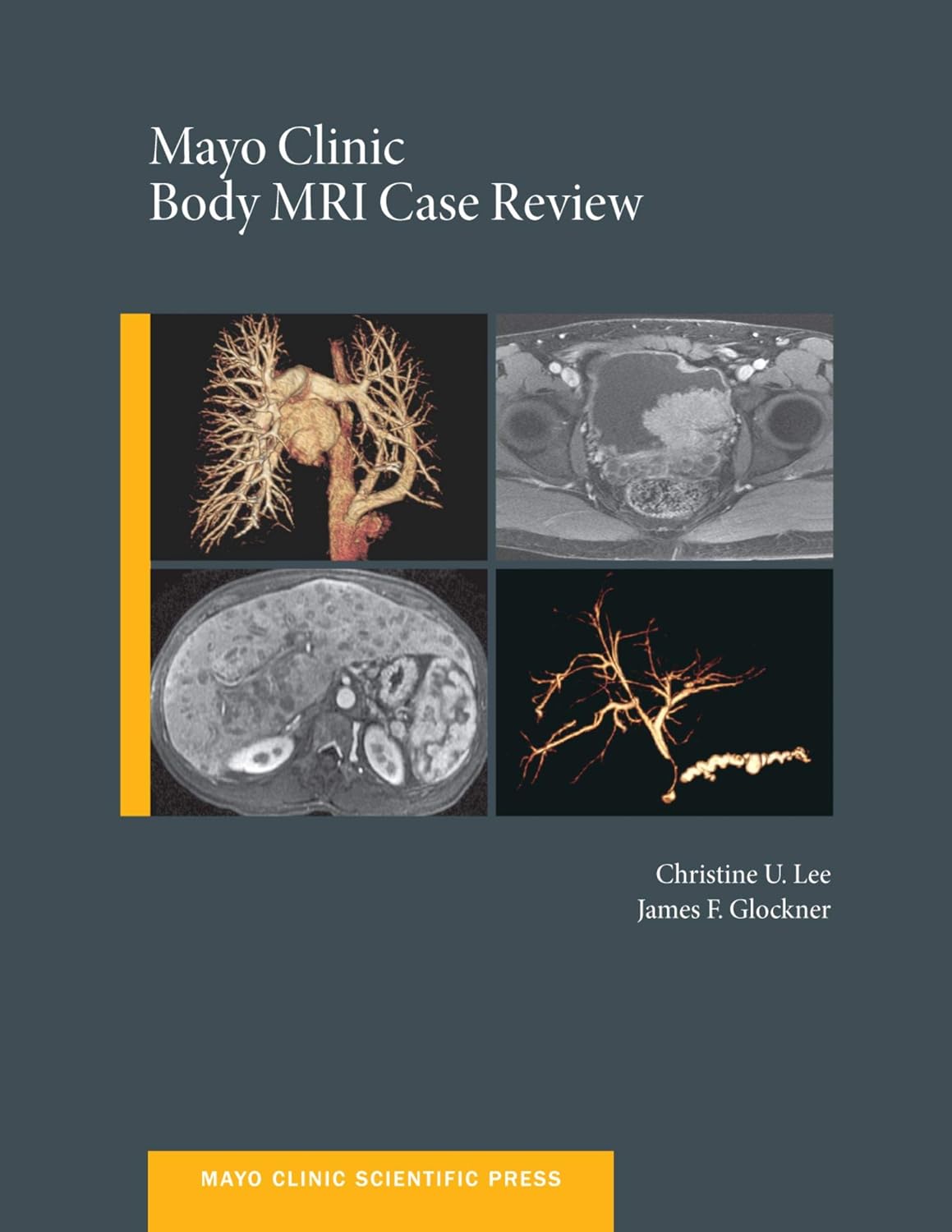 Mayo Clinic Body MRI Case Review (Mayo Clinic Scientific Press) (PDF/EPUB Version)