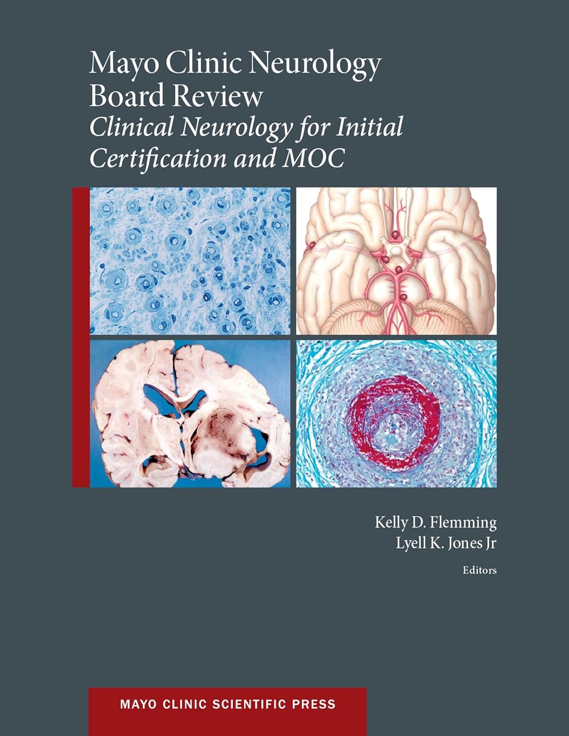 Mayo Clinic Neurology Board Review: Clinical Neurology for Initial Certification and MOC (Mayo Clinic Scientific Press) (PDF/EPUB Version)