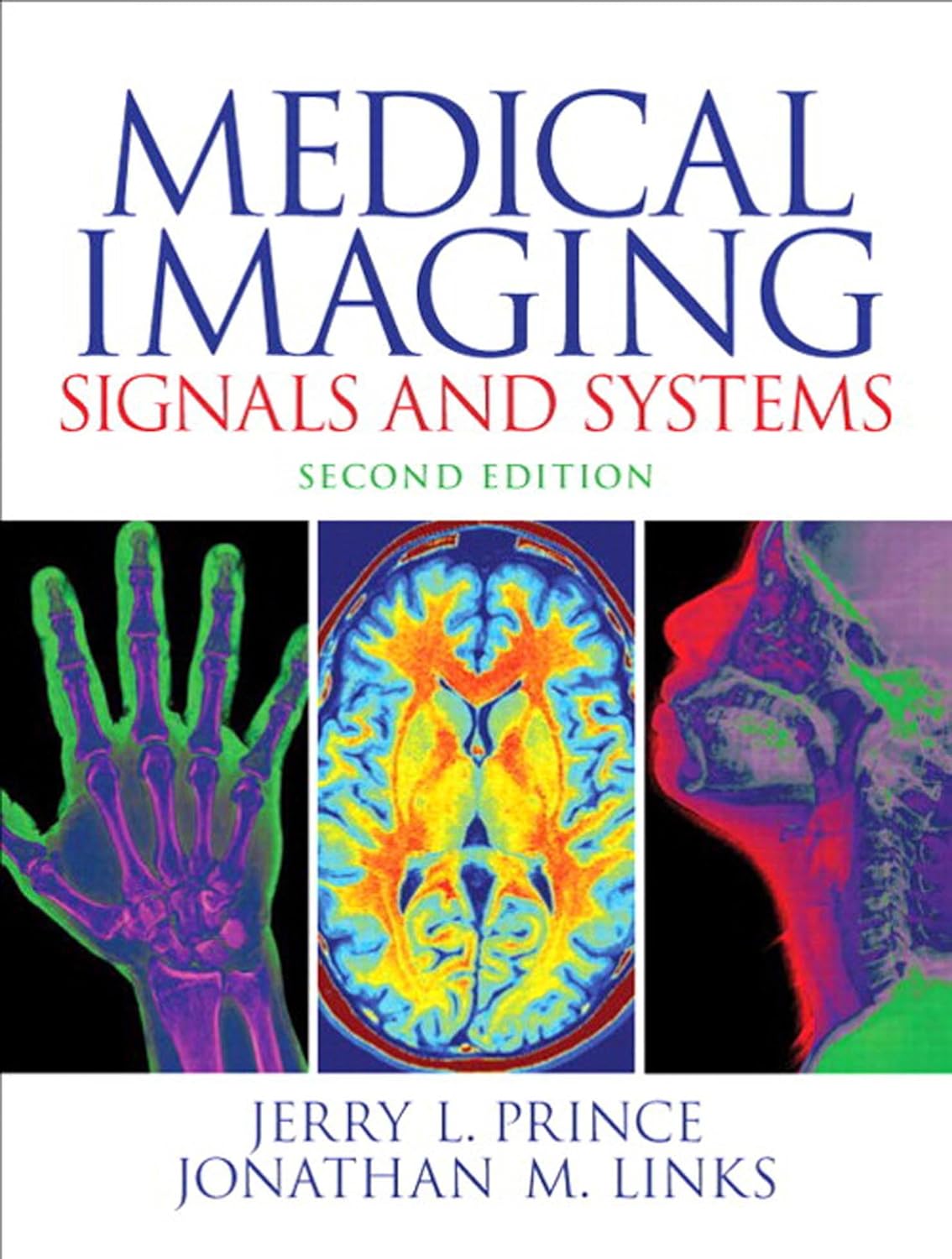 Medical Imaging Signals and Systems (PDF/EPUB Version)