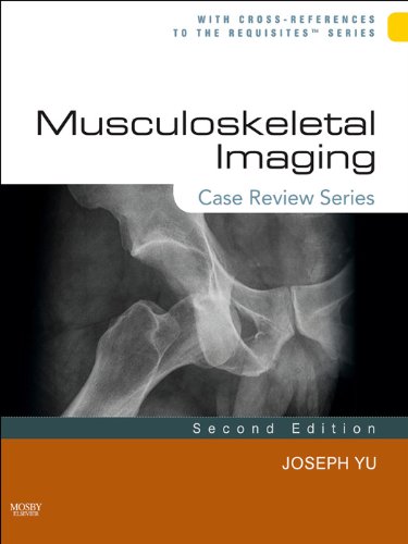 Musculoskeletal Imaging: Case Review Series E-Book (PDF/EPUB Version)