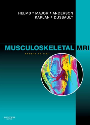 Musculoskeletal MRI E-Book (PDF/EPUB Version)