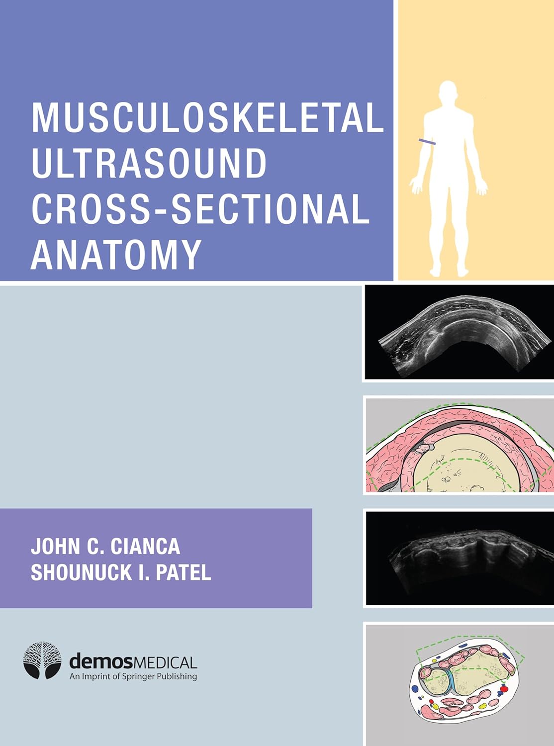 Musculoskeletal Ultrasound Cross-Sectional Anatomy (PDF/EPUB Version)