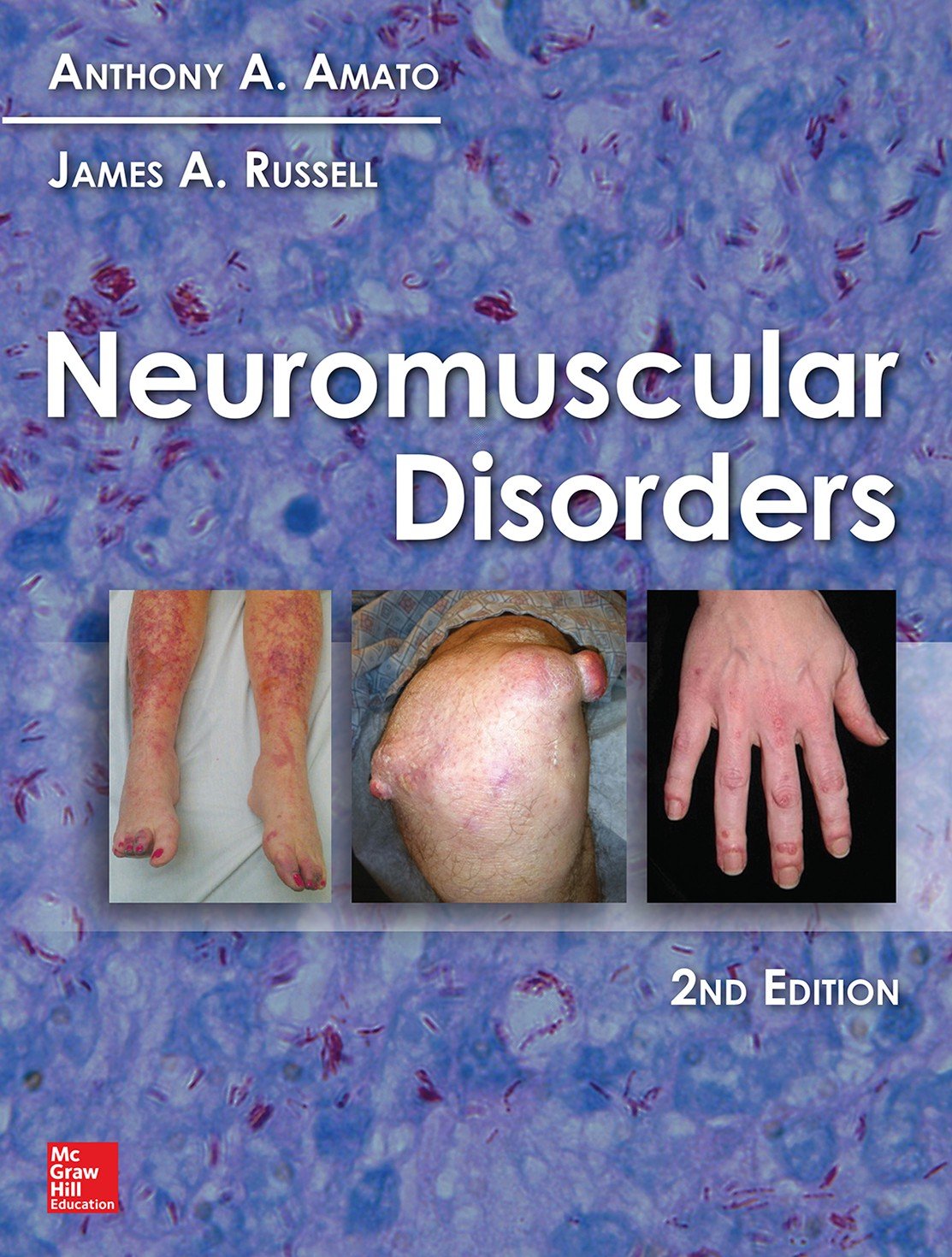 Neuromuscular Disorders, 2nd Edition (PDF/EPUB Version)