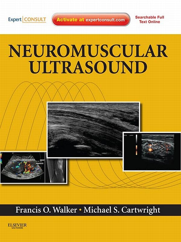 Neuromuscular Ultrasound E-Book: Expert Consult - Online and Print (PDF/EPUB Version)