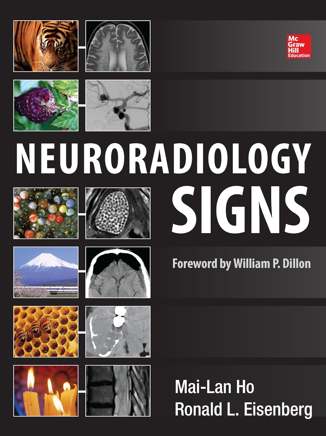 Neuroradiology Signs (PDF/EPUB Version)